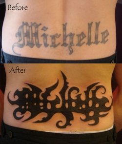 larger tattoo prior to laser tattoo removal requires a much larger ...