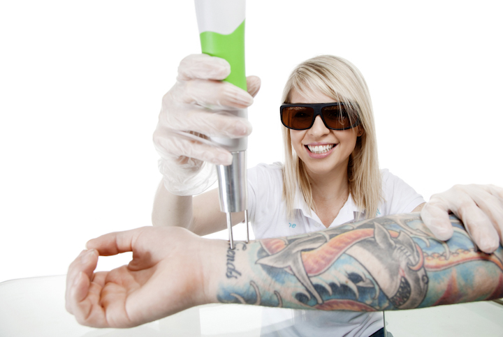 Sydney Laser Tattoo Removal at Think Again Laser Clinic