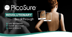 Cynosure PicoSure faster Tattoo Removal guaranteed