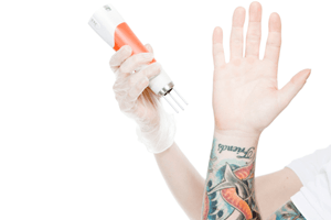 Lets Talk, What Is The Best Laser For Tattoo Removal?