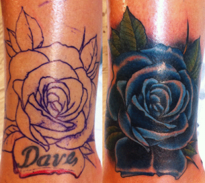 Cover up Vs. Laser Tattoo Removal