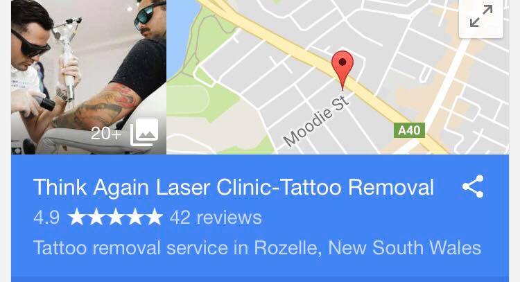 Sydney Laser Tattoo Removal