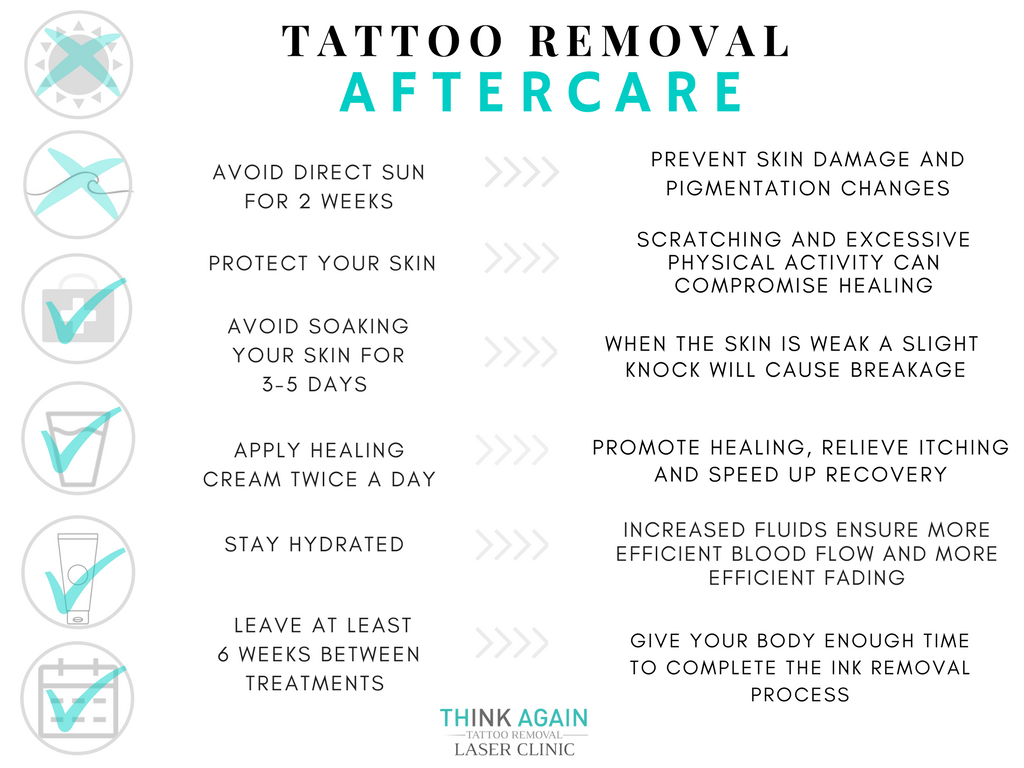 11 things you need to know about tattoo removal  Glamour UK