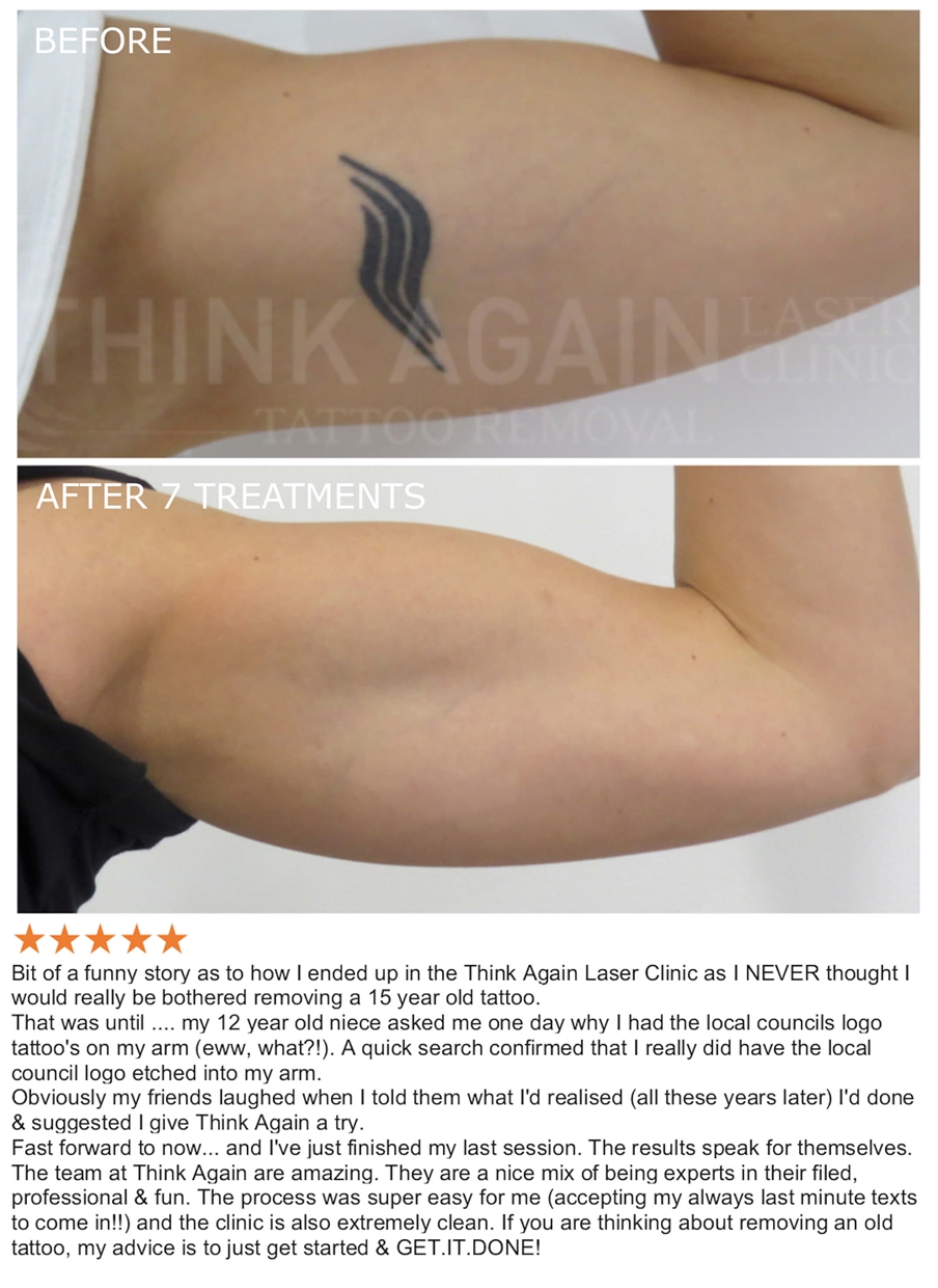 Laser Tattoo Removal Sydney - The #1 Rated Tattoo Removal Clinic
